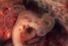 對(duì)人類大腦發(fā)育的獨(dú)特見解：早期胚胎大腦的模型