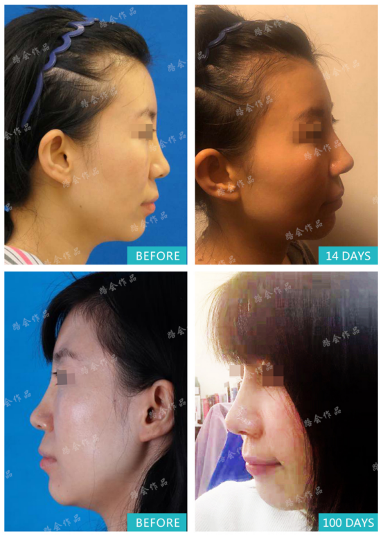 http://sxpa18.cn/uploadfile/2021/0424/20210424115800664.png