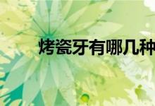 烤瓷牙有哪幾種（烤瓷牙種類(lèi)簡(jiǎn)述）