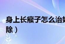 身上長瘊子怎么治好得快（身上長瘊子怎么消除）