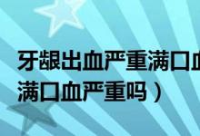 牙齦出血嚴(yán)重滿口血如何治療（牙齦出血嚴(yán)重滿口血嚴(yán)重嗎）