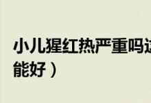 小兒猩紅熱嚴(yán)重嗎這種?。ㄐ盒杉t熱多少天能好）