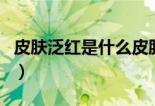皮膚泛紅是什么皮膚病（皮膚泛紅是什么原因）