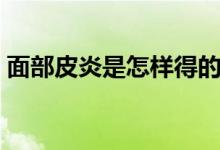 面部皮炎是怎樣得的（面部皮炎是怎么回事）