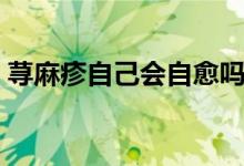蕁麻疹自己會自愈嗎（蕁麻疹能自己自愈嗎）
