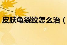 皮膚龜裂紋怎么治（皮膚龜裂應該怎樣護理）