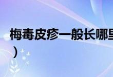 梅毒皮疹一般長(zhǎng)哪里（梅毒皮疹一般長(zhǎng)在哪里）