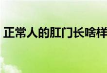 正常人的肛門(mén)長(zhǎng)啥樣（正常的肛門(mén)長(zhǎng)什么樣）