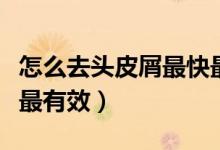怎么去頭皮屑最快最有效（怎么去頭皮屑最快最有效）