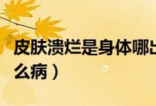 皮膚潰爛是身體哪出現(xiàn)的問題（皮膚潰爛是什么?。?class=