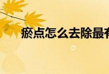 瘀點(diǎn)怎么去除最有效（瘀點(diǎn)怎么去除）