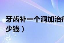 牙齒補(bǔ)一個(gè)洞加治療多少錢（牙齒補(bǔ)一個(gè)洞多少錢）